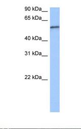 Jurkat cell lysate. Antibody concentration: 0.5 ug/ml. Gel concentration: 12%.