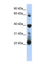 RPUSD3 antibody LS-C110613 Western blot of 721_B cell lysate.