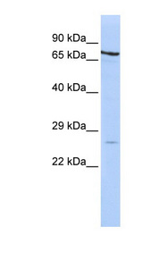 PSMB4 antibody LS-C111924 Western blot of HepG2 cell lysate.