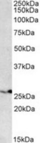 PSMB4 antibody (0.1 ug/ml) staining of HEK293 lysate (35 ug protein/ml in RIPA buffer). Primary incubation was 1 hour. Detected by chemiluminescence.