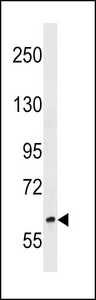 RREB1 Antibody western blot of NCI-H460 cell line lysates (35 ug/lane). The RREB1 antibody detected the RREB1 protein (arrow).