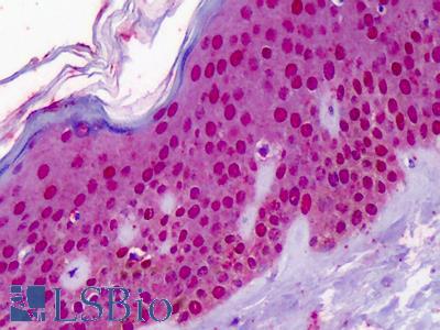 Anti-RREB1 antibody IHC of human skin. Immunohistochemistry of formalin-fixed, paraffin-embedded tissue after heat-induced antigen retrieval. Antibody LS-B4908 concentration 10 ug/ml.