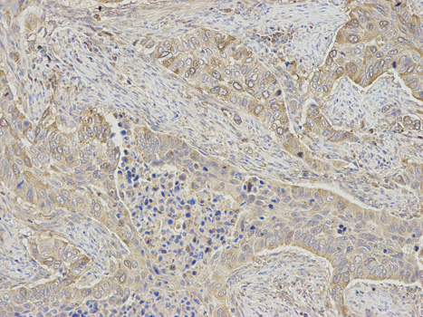 Immunohistochemistry of paraffin-embedded human stomach using RRM2 antibody at dilution of 1:200 (200x lens).