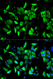 Immunofluorescence analysis of HeLa cell using RRM2 antibody. Blue: DAPI for nuclear staining
