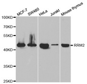 Western blot analysis of extracts of various cell lines, using RRM2 antibody.