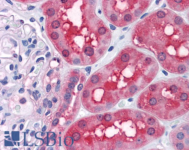 Anti-RRM2 antibody IHC of human kidney. Immunohistochemistry of formalin-fixed, paraffin-embedded tissue after heat-induced antigen retrieval. Antibody LS-B4409 concentration 5 ug/ml.