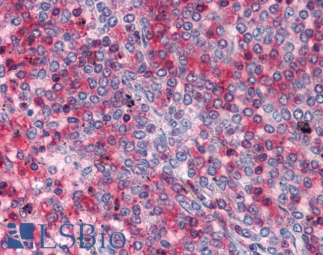 Anti-RRM2 antibody IHC of human spleen. Immunohistochemistry of formalin-fixed, paraffin-embedded tissue after heat-induced antigen retrieval. Antibody LS-B4409 concentration 5 ug/ml.