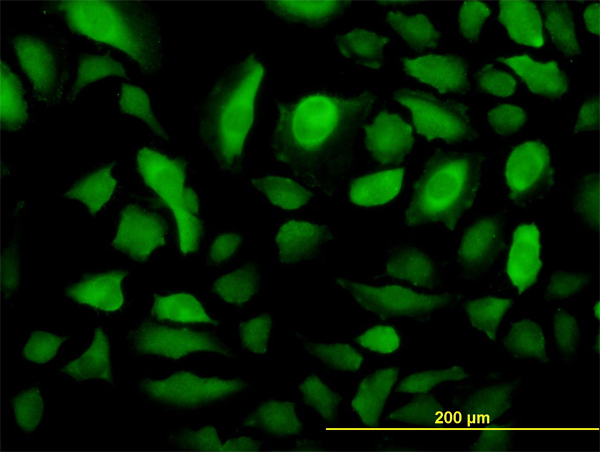 Immunofluorescence of monoclonal antibody to RRM2 on HeLa cell (antibody concentration 10 ug/ml).