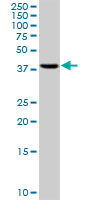 RRM2 monoclonal antibody clone 1E1. Western blot of RRM2 expression in HepG2.