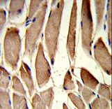 Formalin-fixed and paraffin-embedded human skeletal muscle reacted with RRM2 Antibody , which was peroxidase-conjugated to the secondary antibody, followed by DAB staining. This data demonstrates the use of this antibody for immunohistochemistry; clinical relevance has not been evaluated.