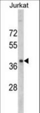 Western blot of RRM2 antibody in Jurkat cell line lysates (35 ug/lane). RRM2 (arrow) was detected using the purified antibody.