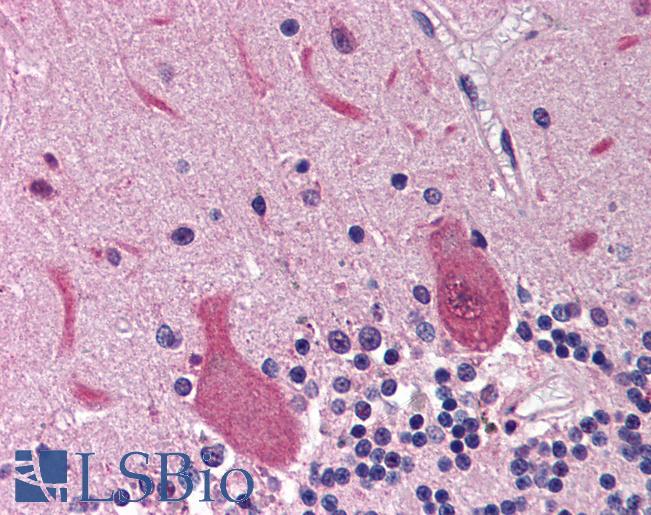 Anti-RRM2B / p53R2 antibody IHC of human brain, cerebellum. Immunohistochemistry of formalin-fixed, paraffin-embedded tissue after heat-induced antigen retrieval. Antibody LS-B545 concentration 5 ug/ml.