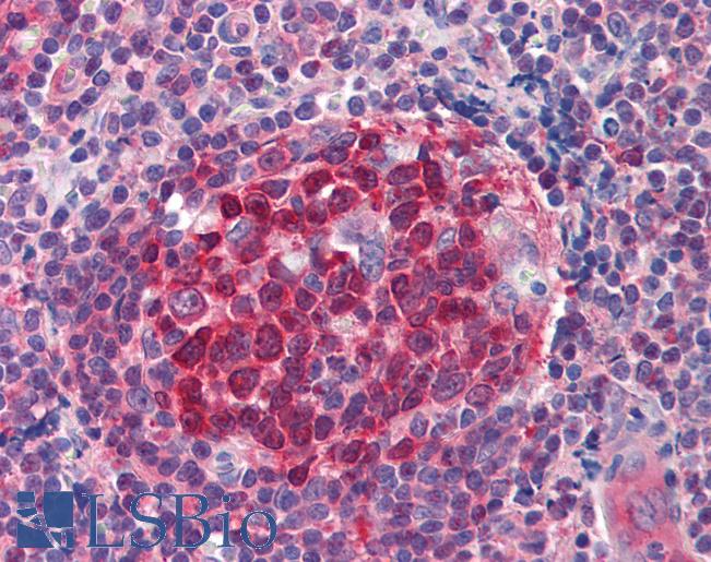 Anti-RRM2B / p53R2 antibody IHC of human tonsil. Immunohistochemistry of formalin-fixed, paraffin-embedded tissue after heat-induced antigen retrieval. Antibody LS-B545 concentration 5 ug/ml.