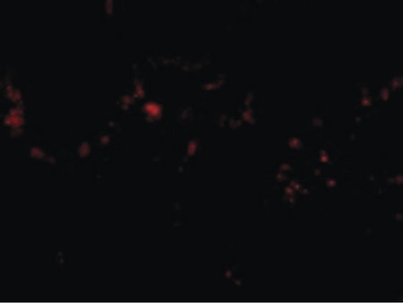 Immunofluorescence of p53R2 in Human Lung cells with p53R2 antibody at 20 ug/ml.