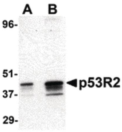 Western blot of p53R2 expression in A431 cell lysate at (A) 0.5 and (B) 1 ug /ml.
