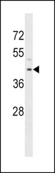 RRM2B Antibody western blot of HepG2 cell line lysates (35 ug/lane). The RRM2B antibody detected the RRM2B protein (arrow).
