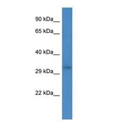 Western blot of Human 293T. RRM2B antibody dilution 1.0 ug/ml.