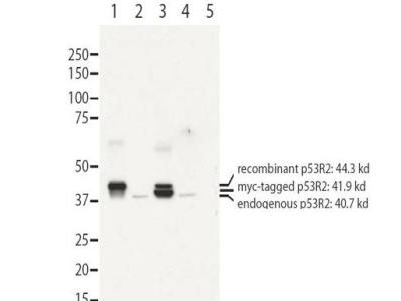 Anti-RRM2B antibody - Western Blot. Western blot of affinity purified anti-RRM2B antibody shows detection of recombinant (lanes 1 and 3) and endogenous protein (lanes 1 to 4) in whole cell extracts from transfected 293T. Lane 1 contains purified recombinant human p53R2. Lane 2 contains 293T cells transfected with control vector. Lane 3 contains 293T transfected with p53R2-myc. Lane 4:293T transfected with ScRNA. Lane 5:293T transfected with p53R2 SiRNA The band at 40.7 kD, indicated by the bottom arrowhead, corresponds to the expected molecular weight of endogenous RRM2B. The band with the middle arrow corresponds to myc-tagged p53R2 at 41.9kD. The highest band at 44.3 kD corresponds to recombinant p53R2. Primary antibody was diluted to 1 ug/mL and incubated overnight at 4C. ECL detection was used.