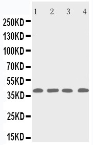 WB of RRM2B antibody. Lane 1: Rat Thymus Tissue Lysate. Lane 2: MCF-7 Cell Lysate. Lane 3: A431 Cell Lysate. Lane 4: HELA Cell Lysate..