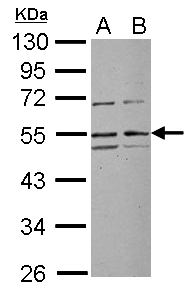 Sample (30 ug of whole cell lysate) A: Jurkat B: Raji 10% SDS PAGE RRP1 antibody diluted at 1:1000