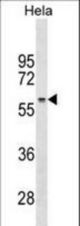 RRP1 Antibody western blot of HeLa cell line lysates (35 ug/lane). The RRP1 antibody detected the RRP1 protein (arrow).