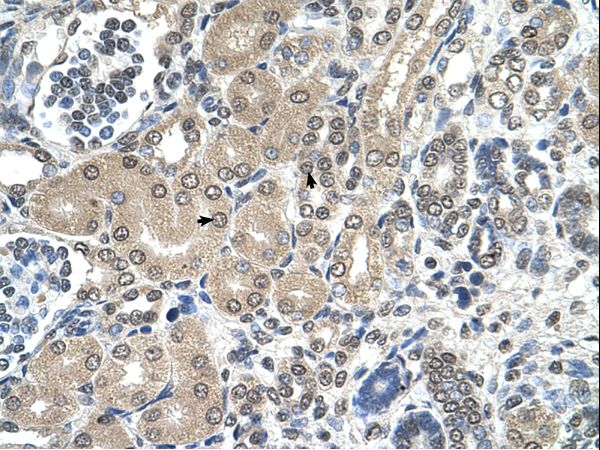 RRP1 antibody LS-C80775 was used in IHC to stain formalin-fixed, paraffin-embedded human kidney.