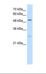 HepG2 cell lysate. Antibody concentration: 0.5 ug/ml. Gel concentration: 12%.