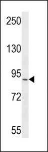 RRP1B Antibody western blot of CEM cell line lysates (35 ug/lane). The RRP1B antibody detected the RRP1B protein (arrow).