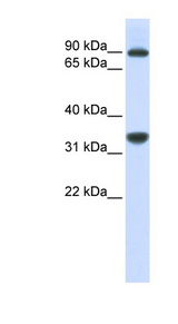 RRP1B antibody LS-C102192 Western blot of MCF7 cell lysate.