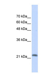 RASL10A antibody LS-C102416 Western blot of Transfected 293T cell lysate.