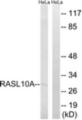 Western blot of extracts from HeLa cells, using RASL10A Antibody. The lane on the right is treated with the synthesized peptide.