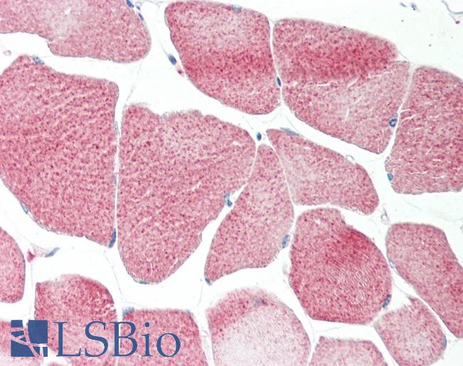Human Skeletal Muscle: Formalin-Fixed, Paraffin-Embedded (FFPE)