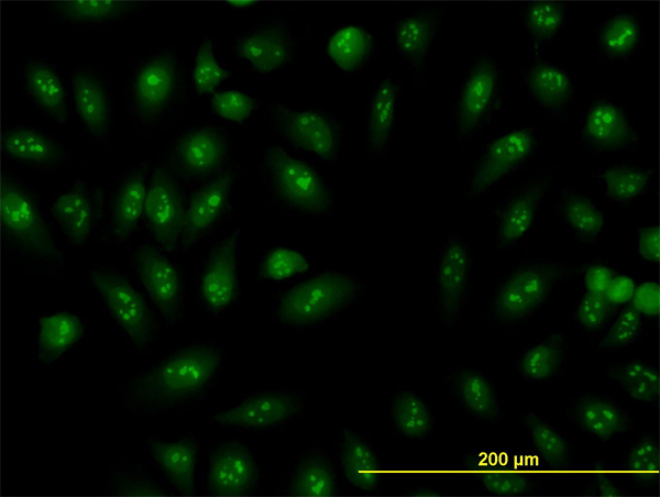 Immunofluorescence of monoclonal antibody to RNU3IP2 on HeLa cell. [antibody concentration 10 ug/ml]