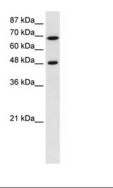 Jurkat Cell Lysate