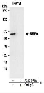 Detection of Human RRP9 by Western Blot of Immunoprecipitates. Samples: Whole cell lysate (1 mg for IP; 20% of IP loaded) from 293T cells. Antibodies: Affinity purified rabbit anti-RRP9 antibody used for IP at 6 ug/mg lysate. For blotting immunoprecipitated RRP9, was used at 1 ug/ml. Detection: Chemiluminescence with an exposure time of 30 seconds.