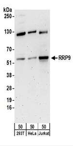Detection of Human RRP9 by Western Blot. Samples: Whole cell lysate (50 ug) from 293T, HeLa, and Jurkat cells. Antibodies: Affinity purified rabbit anti-RRP9 antibody used for WB at 0.4 ug/ml. Detection: Chemiluminescence with an exposure time of 3 minutes.
