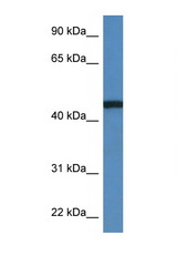RRS1 antibody LS-C145421 Western blot of MCF7 Cell lysate. Antibody concentration 1 ug/ml.