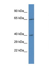 RRS1 antibody LS-C145422 Western blot of 293T Cell lysate. Antibody concentration 1 ug/ml.