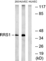 Western blot of extracts from HUVEC/293 cells, using RRS1 Antibody. The lane on the right is treated with the synthesized peptide.