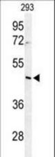 Western blot of RRS1 Antibody in 293 cell line lysates (35 ug/lane). RRS1 (arrow) was detected using the purified antibody.