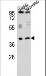 Western blot of RSAD1 Antibody in HepG2,NCI-H460 cell line lysates (35 ug/lane). RSAD1 (arrow) was detected using the purified antibody.