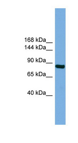 RSBN1 antibody LS-C116667 Western blot of Fetal Lung lysate.