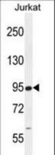 RSBN1 Antibody western blot of Jurkat cell line lysates (35 ug/lane). The RSBN1 antibody detected the RSBN1 protein (arrow).
