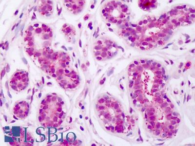 Anti-RSF1 / RSF-1 antibody IHC staining of human breast, epithelium. Immunohistochemistry of formalin-fixed, paraffin-embedded tissue after heat-induced antigen retrieval.