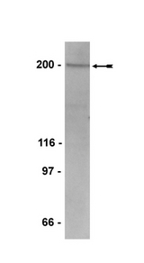 WB: HeLa nuclear extract was probed with anti-Rsf-1, clone 5H2/E4 (1:2000 dilution).