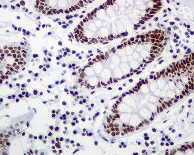 IHC of paraffin-embedded human colon tissue using anti-Rsf-1 antibody.