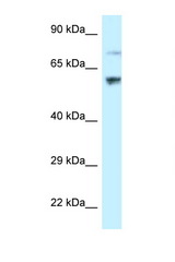 RSL1D1 antibody LS-C145829 Western blot of HeLa Cell lysate. Antibody concentration 1 ug/ml.