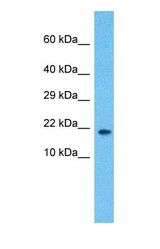 Western blot of RLP24 Antibody with human MCF7 Whole Cell lysate.