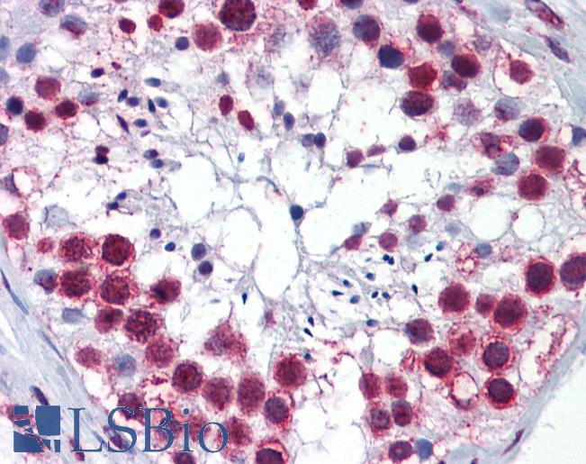 Anti-RSL24D1 / C15orf15 antibody IHC of human testis. Immunohistochemistry of formalin-fixed, paraffin-embedded tissue after heat-induced antigen retrieval. Antibody LS-B6227 concentration 1 ug/ml.