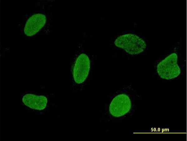Immunofluorescence of monoclonal antibody to C15orf15 on HeLa cell. [antibody concentration 10 ug/ml].